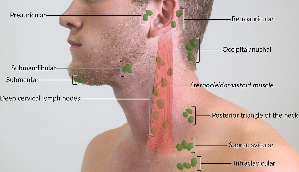 <ol start="2"><li><p><span style="background-color: transparent;"> above the clavicle</span></p></li></ol><p></p><p>Reasoning:</p><p>Scalene Node</p><p>Left supraclavicular node</p><p>Virchow’s node </p><p></p>