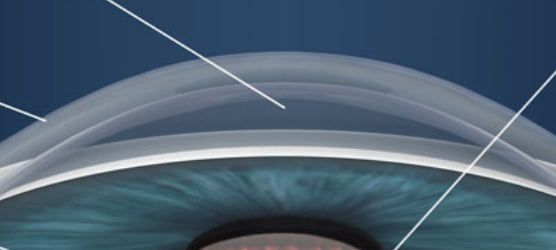 <p>transparent fluid filled space </p>