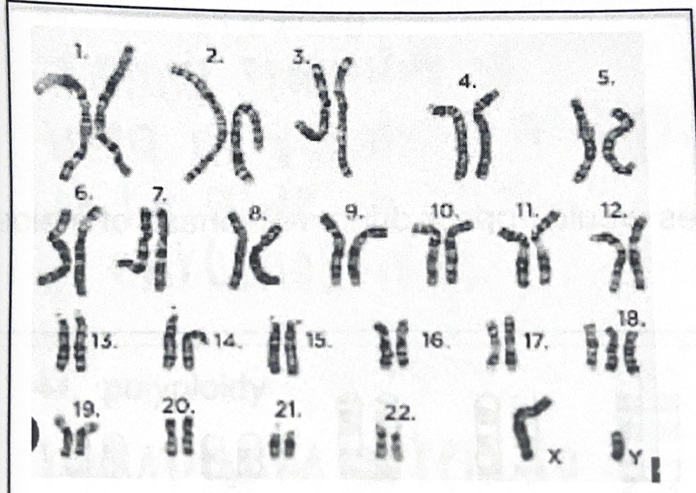 <p>examine the karyotype</p>
