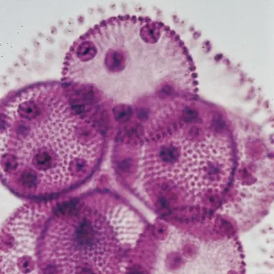 <p>~200-300 µm</p>