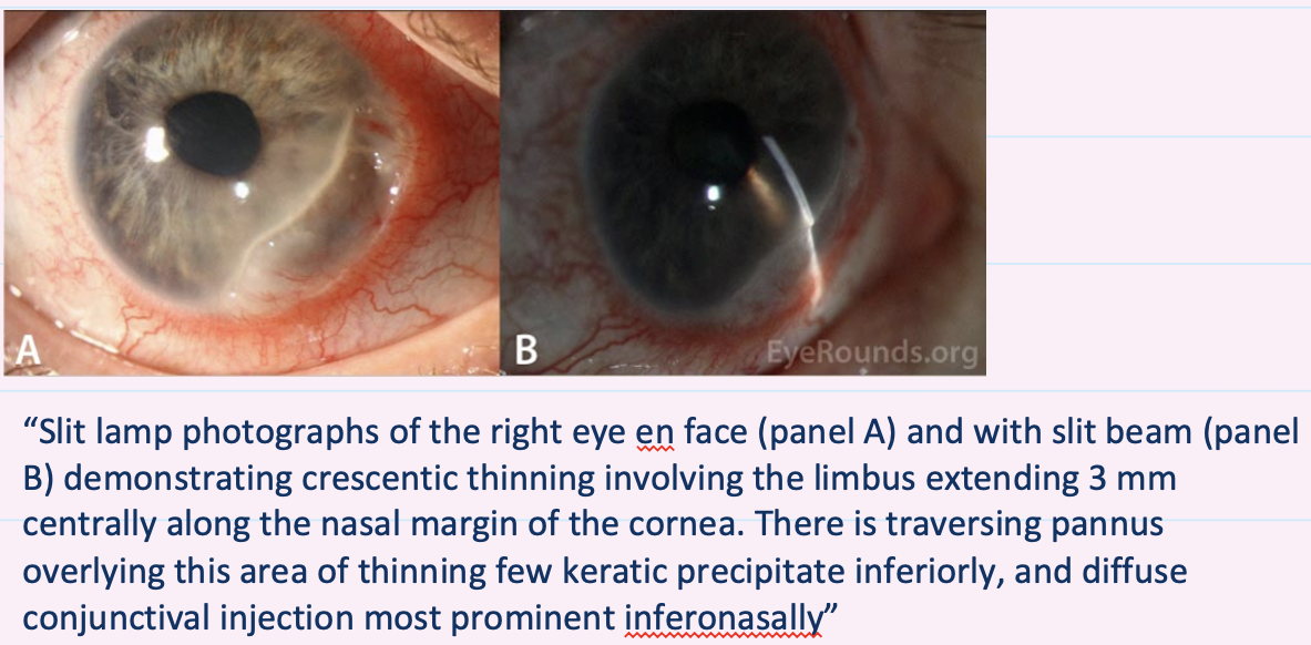 <p>Describe and give diagnosis</p>