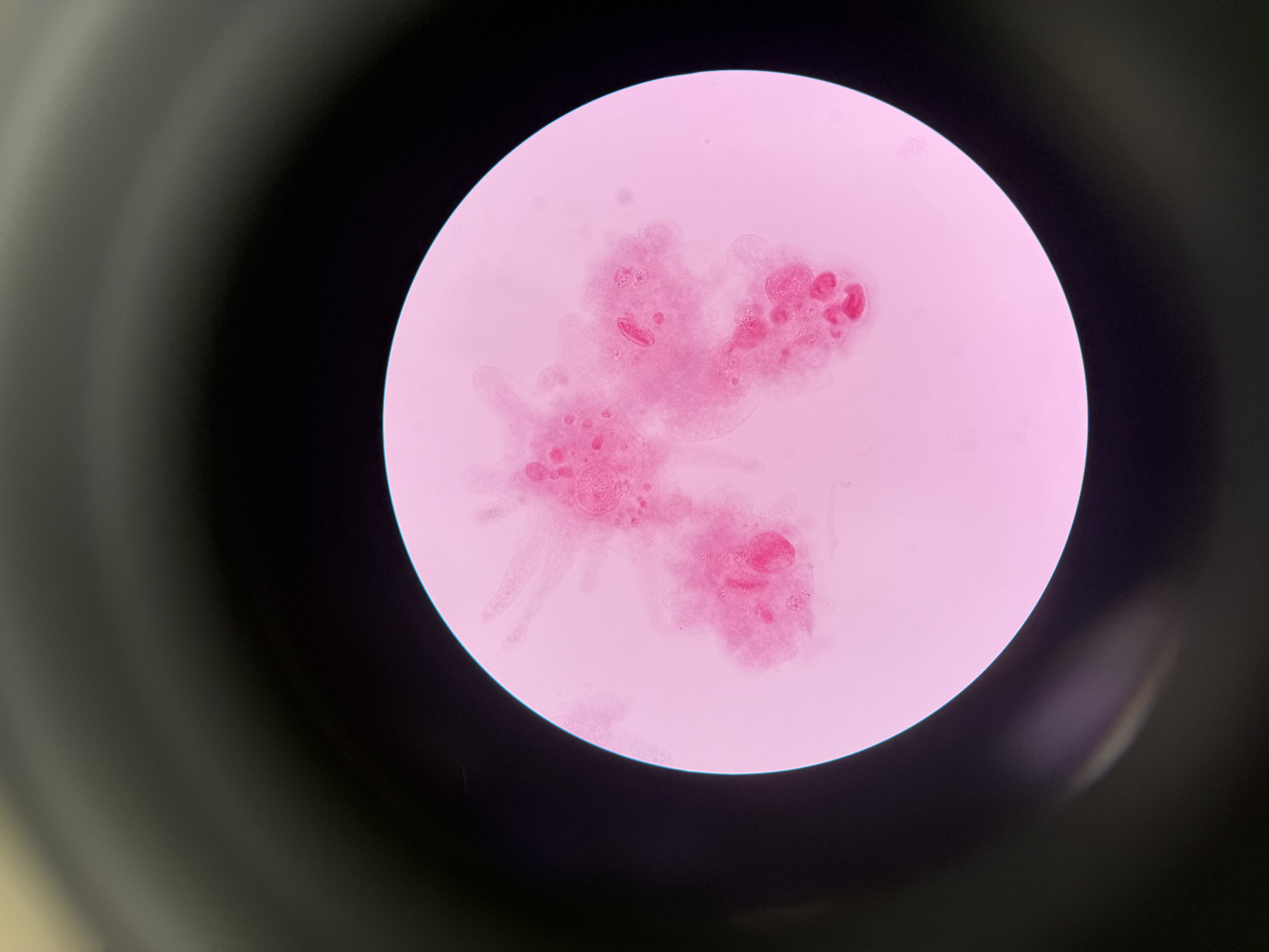 <ol><li><p>What is this?</p></li><li><p>What phylum?</p></li><li><p>Spore location?</p></li><li><p>Autotrophic or heterotrophic?</p></li><li><p>Unicellular or multicellular?</p></li><li><p>What supergroup?</p></li><li><p>What do they use to move and engulf their food? Can you identify it?</p></li></ol><p></p>
