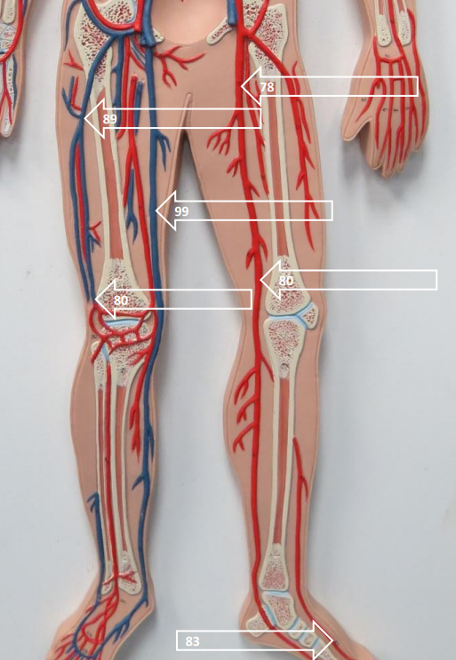 <p>Label this image.</p>