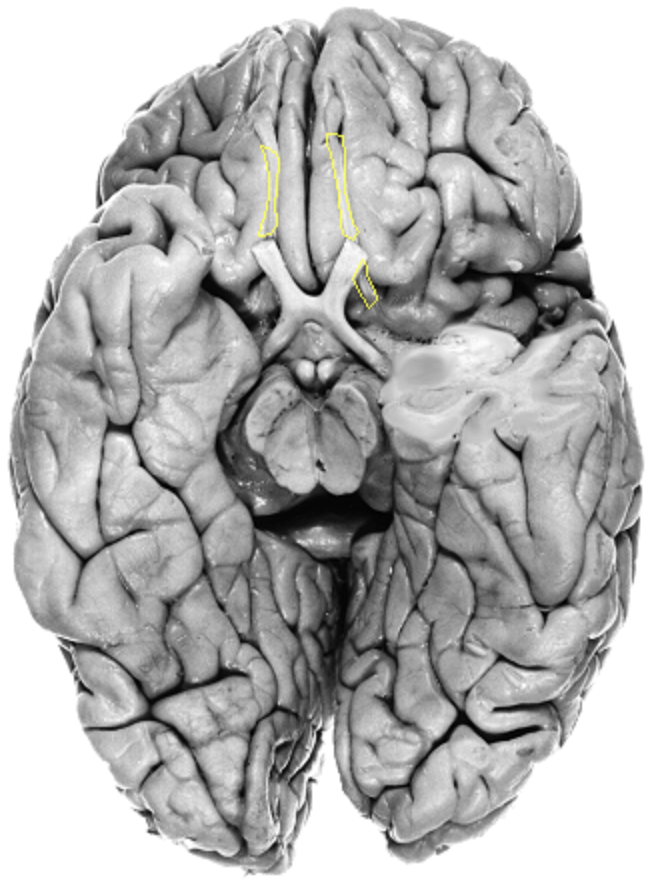 <p>What is the area highlighted called?</p>