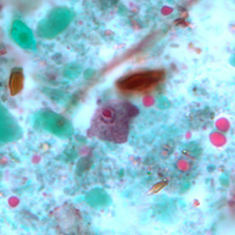 <ol><li><p>Iodamoeba buetschlii</p></li><li><p>Trophozoite</p></li></ol><p></p>