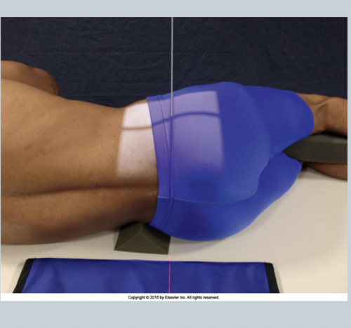 <p>Patient is in true lateral position </p><p>Knees and elbows flexed and placed on top of each other </p><p>Shoulders and hips are placed on the same plane</p>