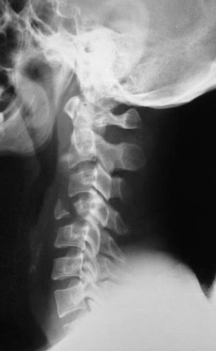 <p>What is the diagnosis?</p>
