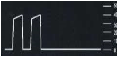<p>What is this ETCO2 waveform</p>