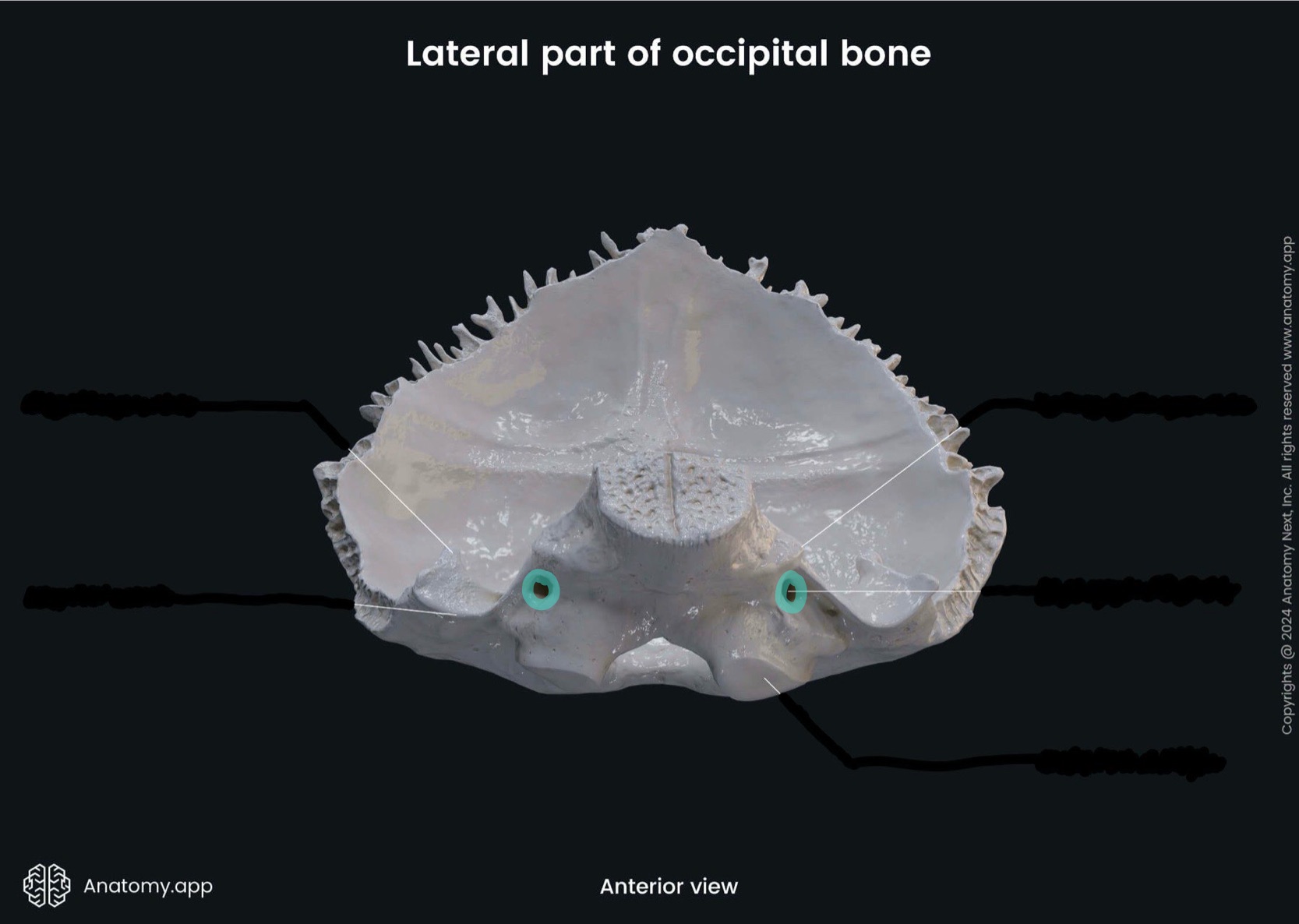 <p>What is the highlighted bony landmark</p>