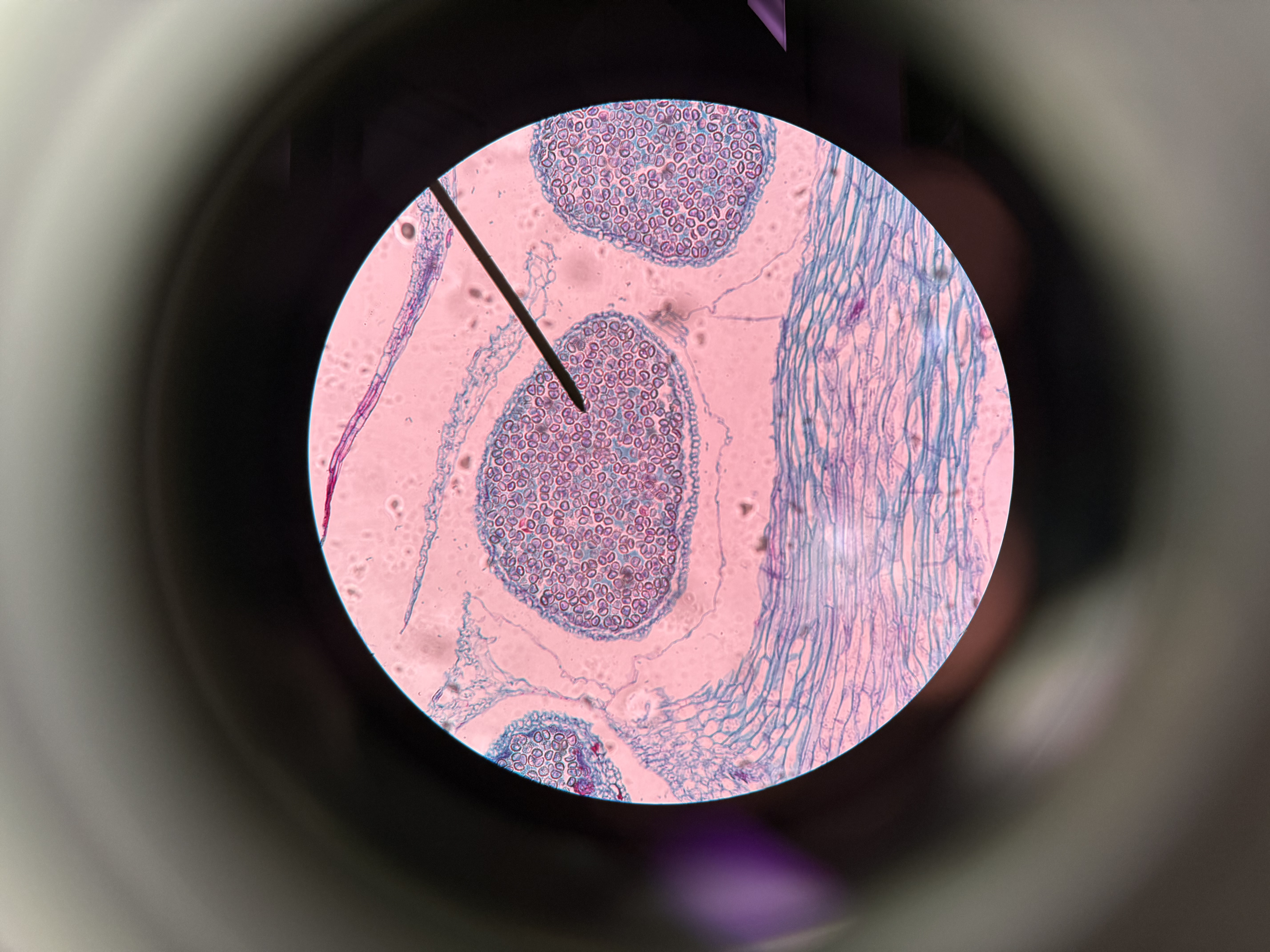 <ol><li><p>What is this organism?</p></li><li><p>What is the pointer pointing at?</p></li><li><p>What is enclosing the answer to question 2?</p></li></ol><p></p>