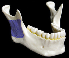<p>a part of the mandible</p>