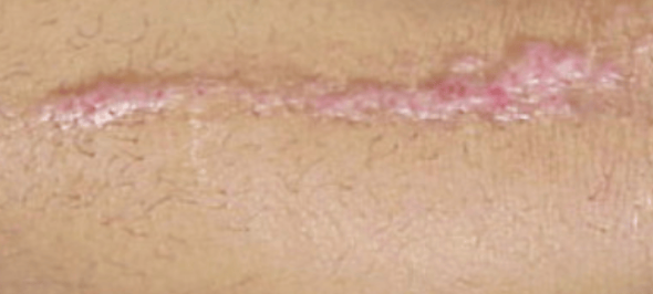 <p>Linear</p>