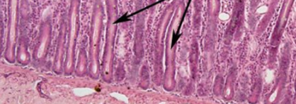 <p>what are arrows pointing to (jejunum)</p>