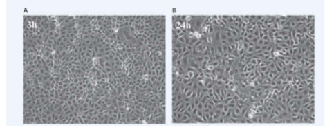<p>Virus infected cells may display cytopathic effects</p>