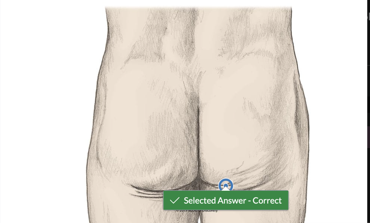 <p><br><span>Using hot spot technology identify where the RIGHT gluteal fold is located.</span></p>