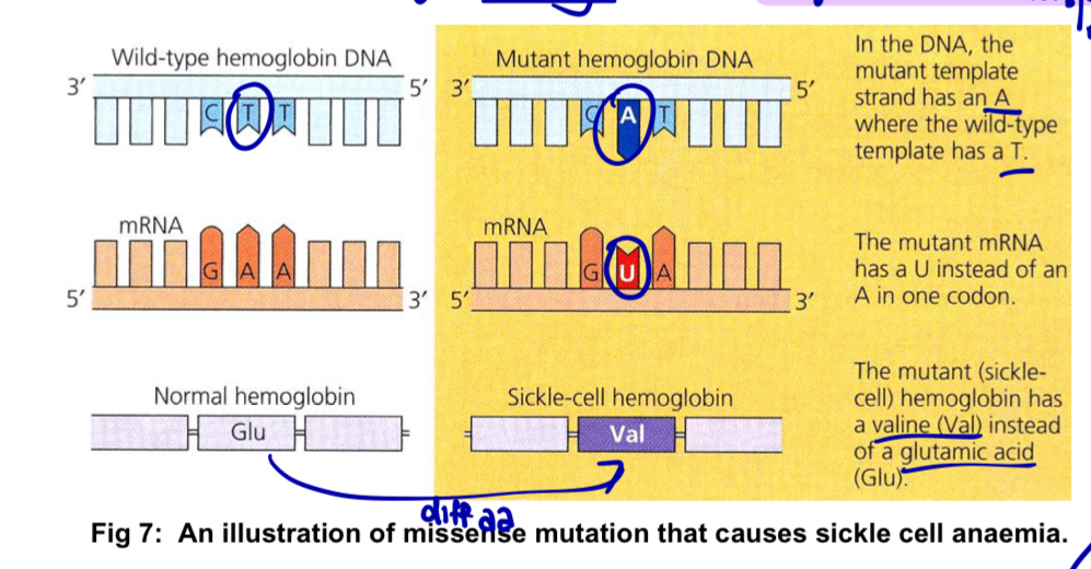 <p><strong>—> Sickle-cell anaemia</strong> (how gene mutations can result in disease)</p><ul><li><p>involves a <u>mutation</u> in the <strong>β-globin gene</strong>, which encodes one of the polypeptide subunits that make up <u>haemoglobin</u> (Hb) (Hb - 2α and 2β subunits)</p></li></ul><p><u>Genetic and molecular basis</u></p><ul><li><p>substitution of a thymine for an adenine at one position in the Hb gene (template strand), which results in a <strong>missense mutation</strong></p></li></ul><p><strong>T —> A</strong></p><ul><li><p>6th amino acid residue in polypeptide is changed from a <strong>glutamate</strong> (<u>hydrophilic</u>) to a <strong>valine</strong> (<u>hydrophobic</u>)</p></li><li><p>change in <strong>property</strong> of amino acid —> change in the i<strong>nteractions/bonds </strong>formed with neighbouring a.a</p></li></ul><p>= specific three-dimensional conformation and function of the Hb protein is altered</p><ul><li><p>this substitution creates a <u>hydrophobic spot</u> on the <u>outside of the Hb protein</u> that <u>sticks</u> to the hydrophobic region of an <u>adjacent Hb protein’s beta chain</u></p></li><li><p>mutant Hb subunits tend to <u>stick to one another </u>when the <u>oxygen concentration</u> is <u>low</u>, particularly when the red blood cells are in capillaries and veins</p></li><li><p>the <u>aggregated proteins </u>form <u>fibre-like structures </u>within red blood cells</p></li><li><p>at high oxygen concentration, haemoglobin resumes globular haemoglobin structure</p></li></ul><p><u>Physiological effects</u></p><ul><li><p>the fibre-like structures cause the RBC to <u>lose their normal morphology</u> and become <u>sickle</u>-shaped</p></li><li><p>sickles cells are <u>less able to move through capillaries</u> and can <u>block blood flow</u>, resulting in severe pain and cell death of the surrounding tissue due to shortage in oxygen</p></li><li><p>the sickles RBC are also <u>fragile and easily destroyed</u>, further decreasing the oxygen carrying capacity of the blood</p></li></ul><p></p><p>*point mutation (nucleotide substitution) —> change in a.a sequence —> change in protein structure (3D conformation) —> change in protein function (decreased capacity to carry blood cos of the change in morphology of RBC) —> disease </p>