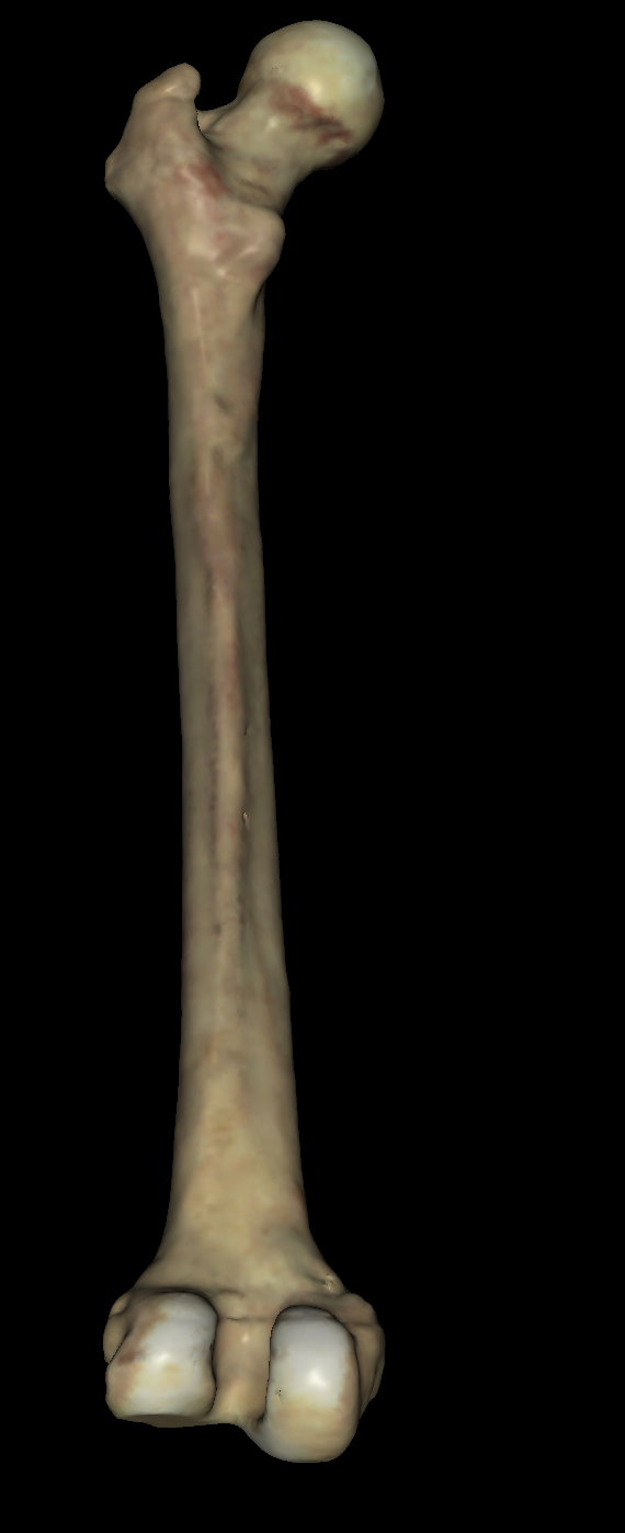 <p>is this the left or right femur? (posterior view)</p>