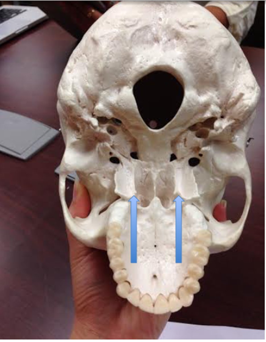<p>What is this boney feature?</p>