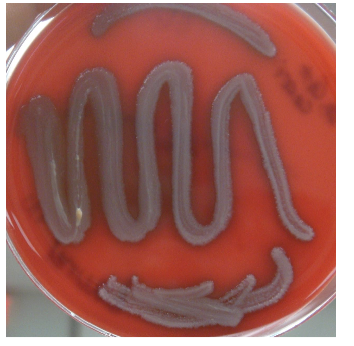<p>name bacteria that is <strong>gamma</strong> hemolysis?</p>