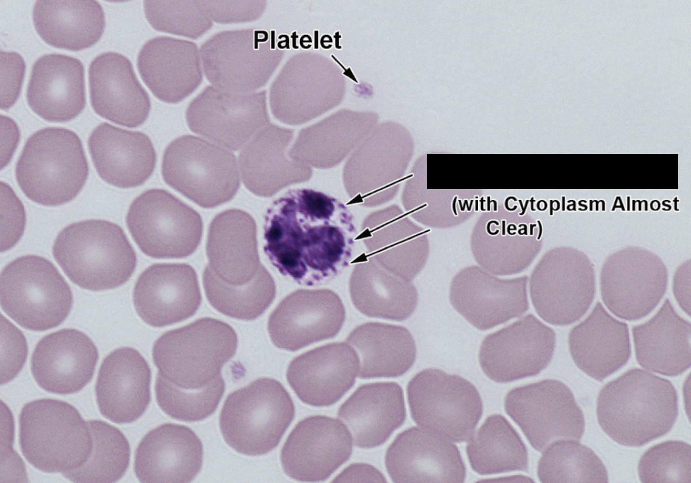 <p>Purple granulates </p>