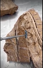<p>Name the ligament</p>