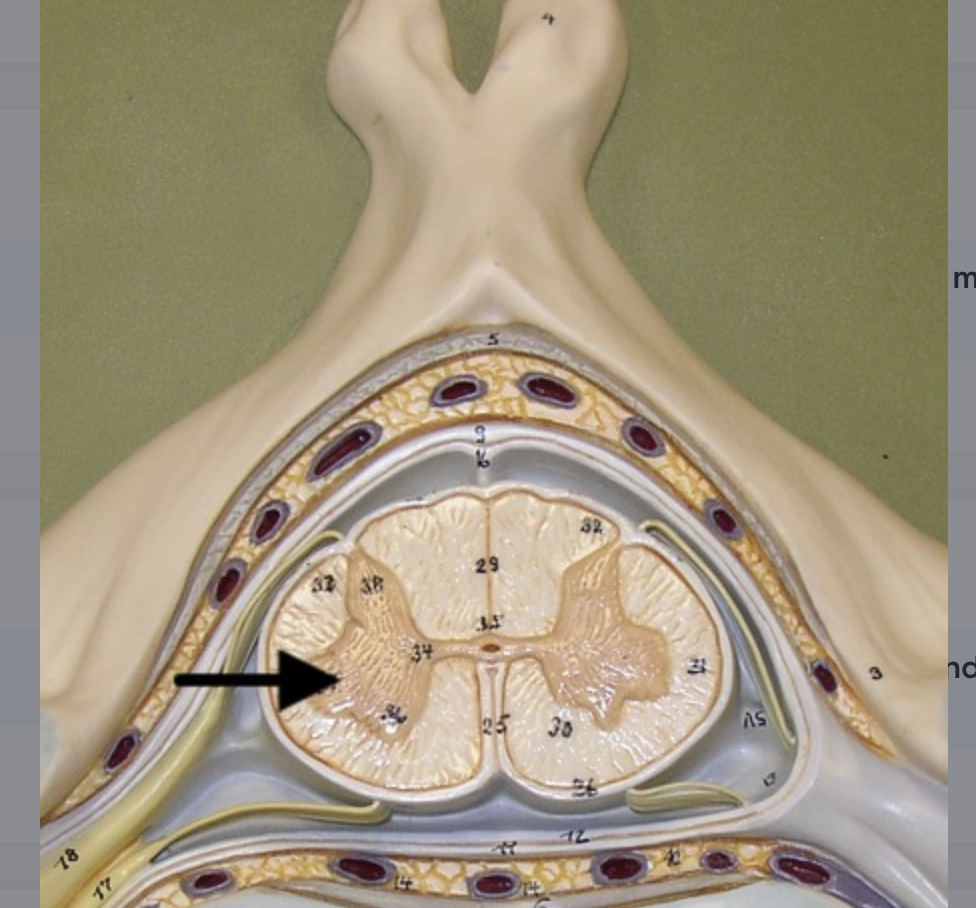 <p>origin of sympathetic visceral motor neurons of autonomic nervous system (ANS); located in T1-L2 spinal cord segments only</p>