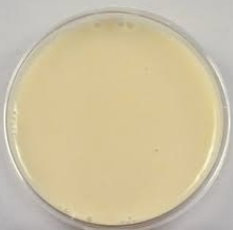 <p>What is the plate used here, what kind of test is conducted, media, inoculation guide, incubation, theory, results, and everything else about it?</p>