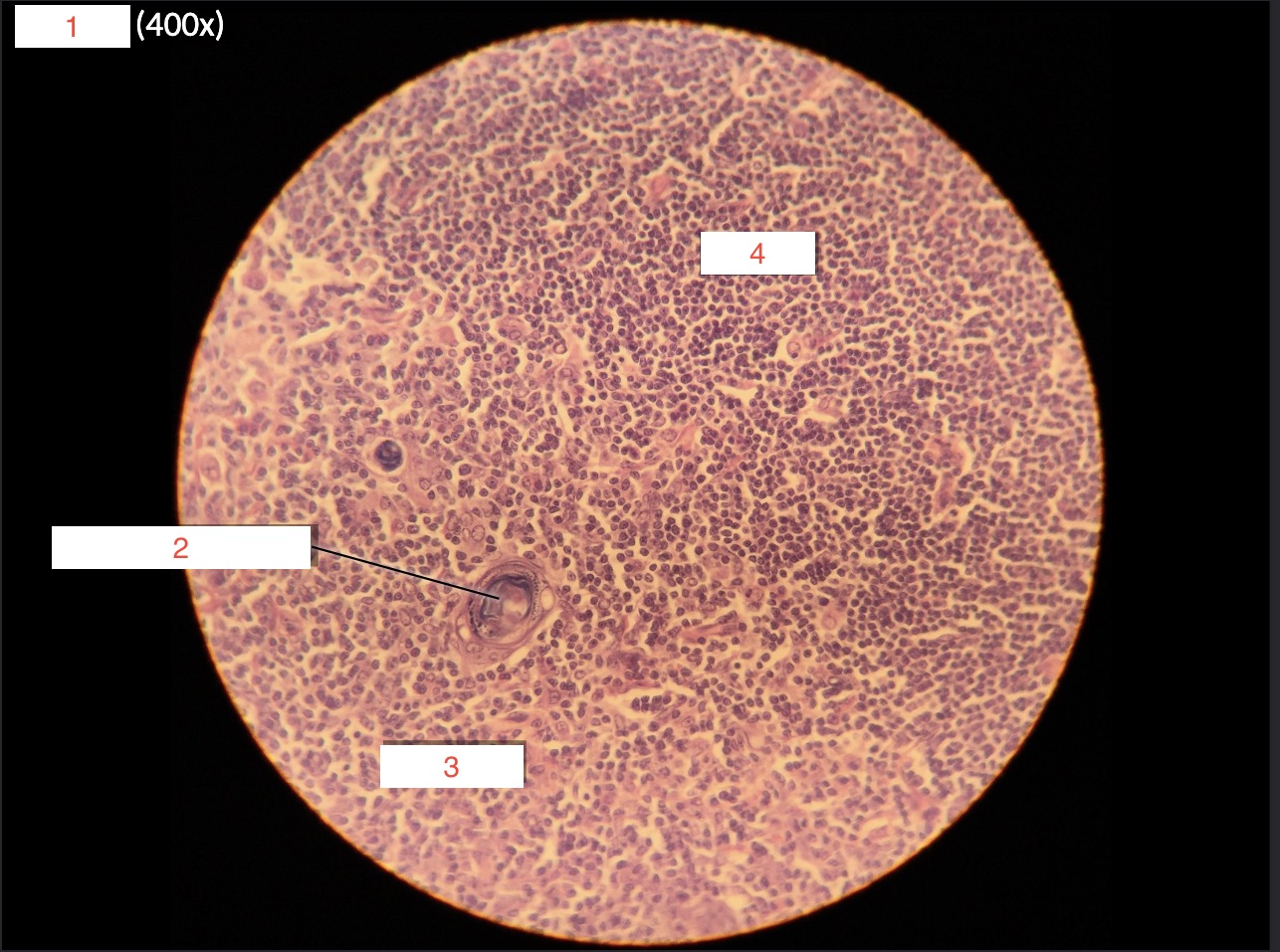 <p>1- What is this slide?</p>
