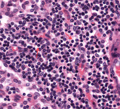 <p>Most of the cells and those indicated on this slide are ....?</p>