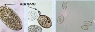<ul><li><p><span>parasitic flatworm eggs (trematodes/flukes)</span></p></li><li><p>Fasciola hepatica<span> (Sheep liver fluke)</span></p></li></ul><p></p>