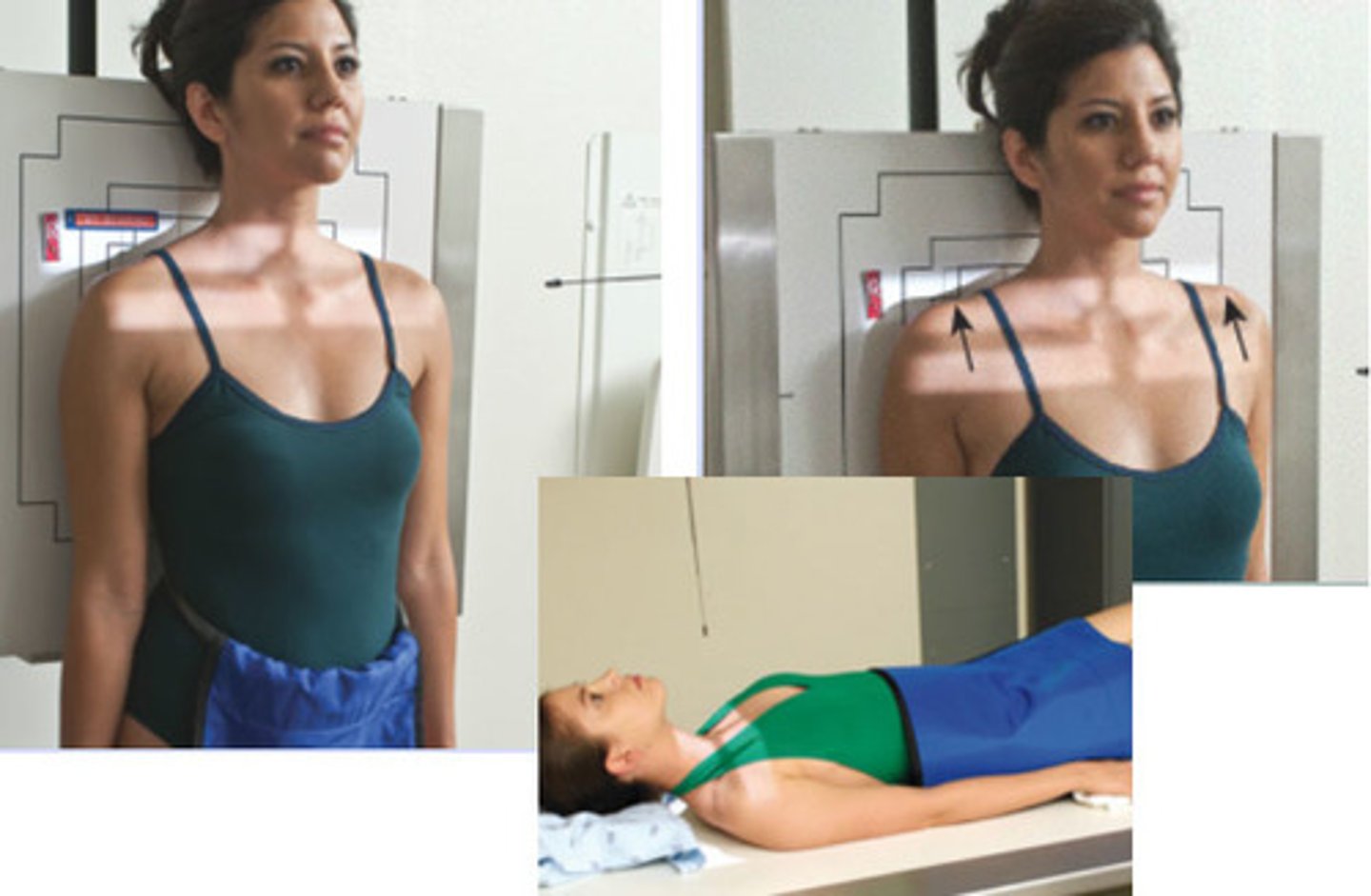 <p>S - around waist</p><p>T - 8 mAs @ 70 kVp</p><p>A - none</p><p>M - both markers</p><p>P - PT stands w/ back to board holding weights, CR 1" above jug notch</p><p>S - 72"</p><p>B - suspension</p><p>C - 14 x 17 crosswise, collimate top to bottom</p>
