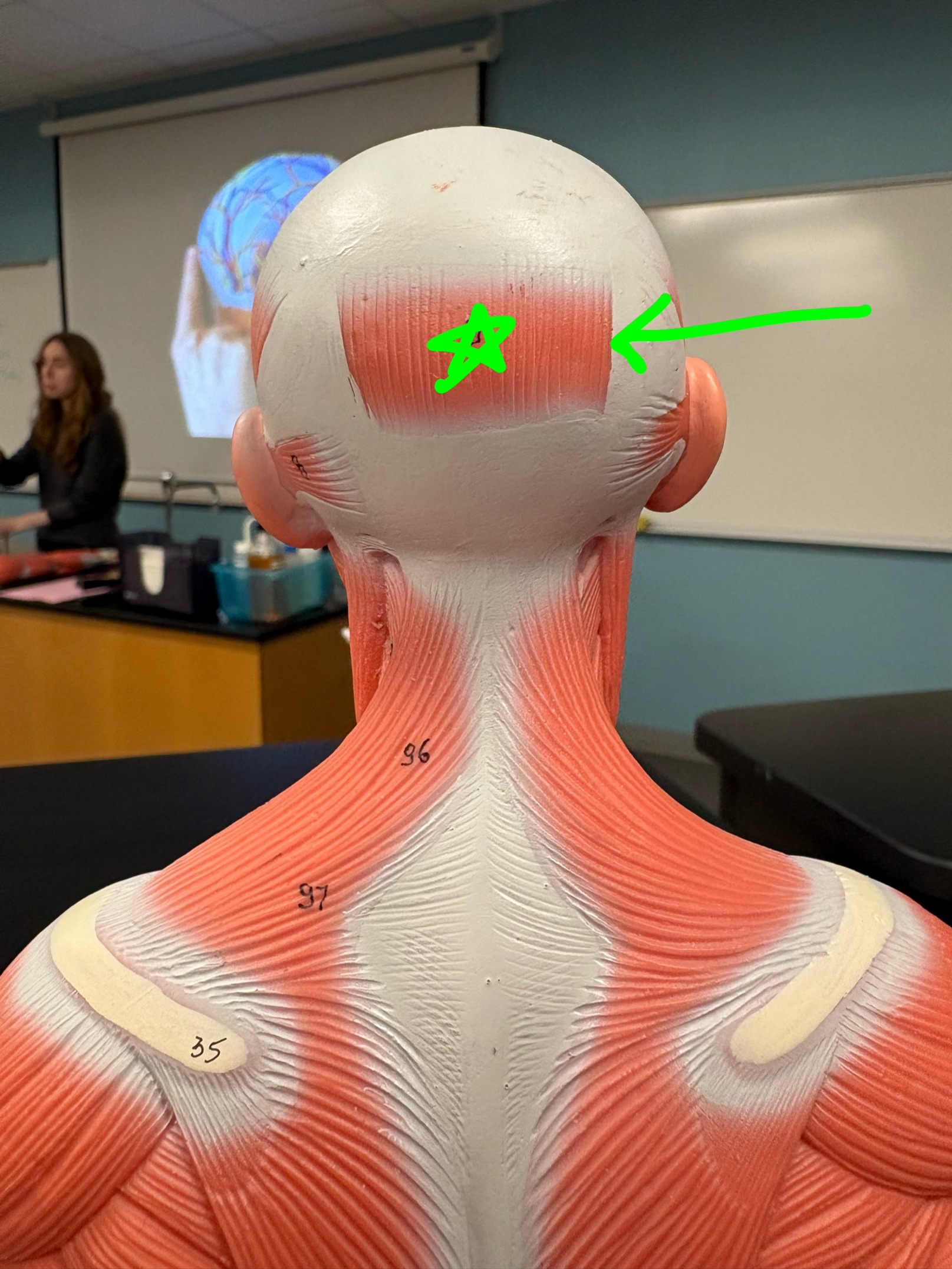 <p>Name the muscle.</p>