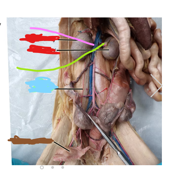 <p>what is the thing labeled red</p>