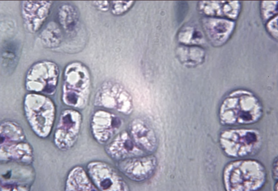 <p>What tissue type is present?</p>