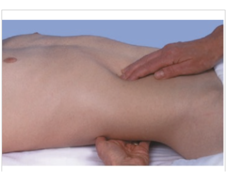 <p><span>The nurse is assessing the client and performs the assessment shown. What is the nurse assessing?</span></p>