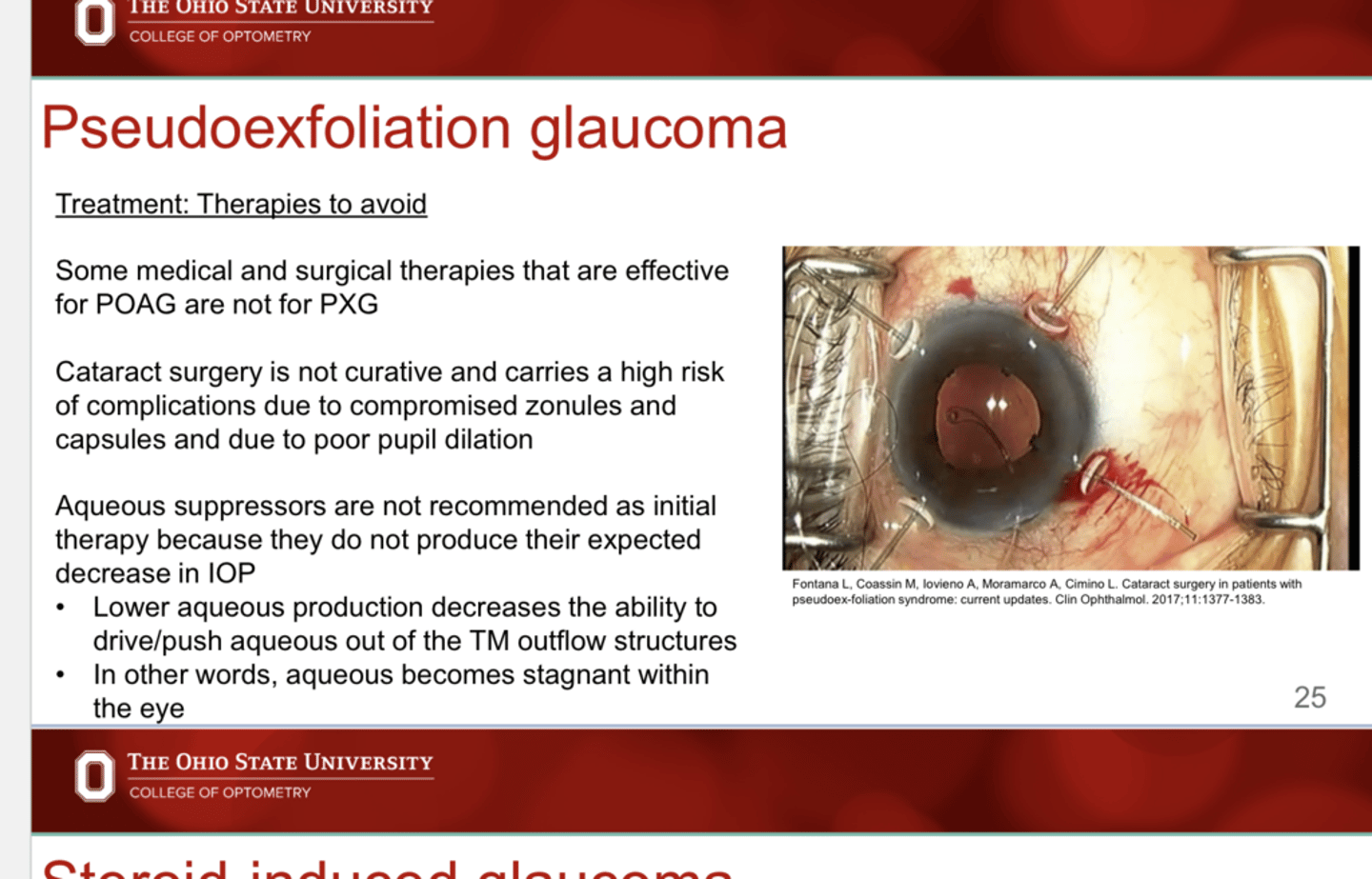 <p>Why are aqueous suppressors NOT recommended as initial therapy for PXG?</p>