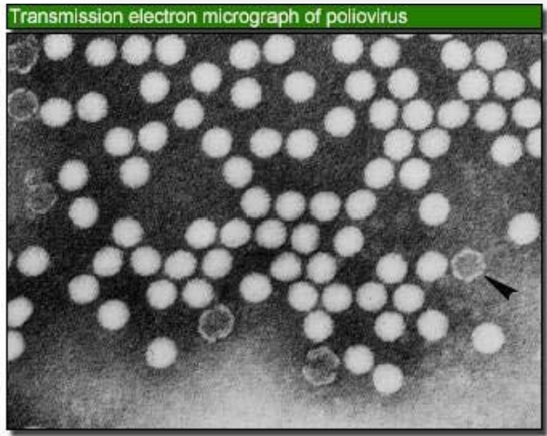 <p>Describe the <strong>Disease Symptoms</strong> of this waterborne virus:</p><p>-<strong>Enterovirus</strong></p>
