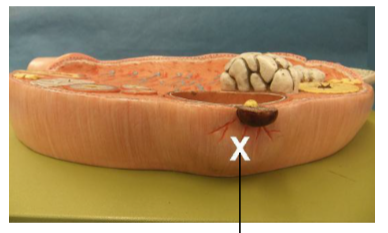 <p>Identify the X structure. </p>