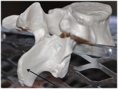 <p>Name this specific part of the lumbar vertebra.</p>