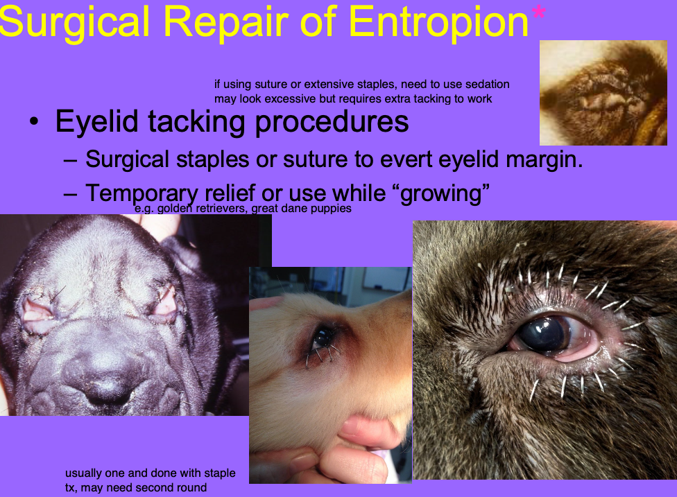 <p>Surgical staples or suture to every eyelid margin.</p><p>Temporary relief or use while growing.</p>