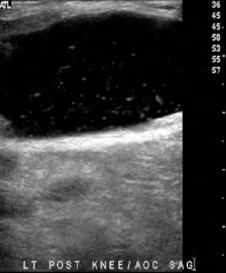 <p>Identify this image. </p>