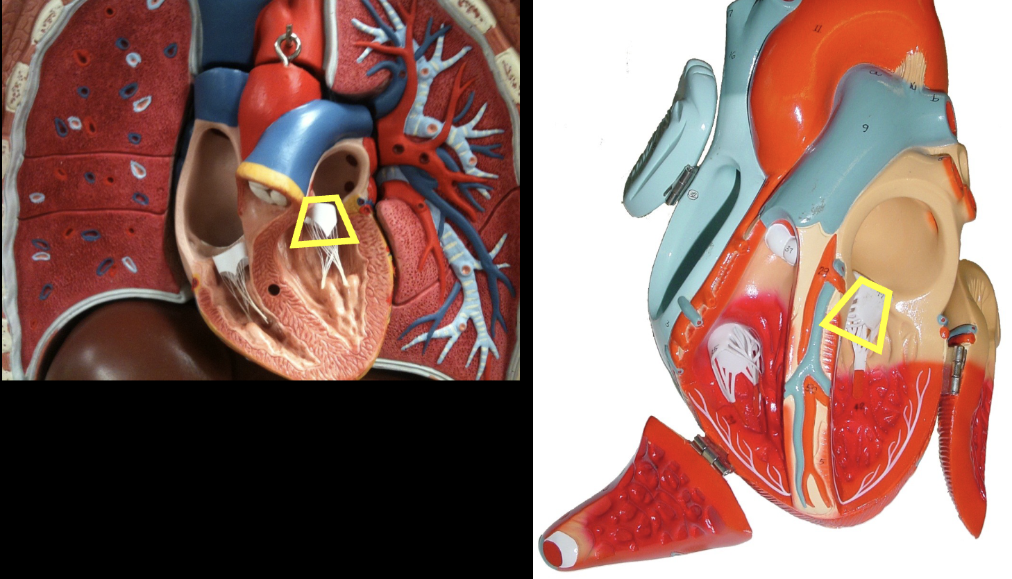 <p>what part of the heart muscle is shown?</p>