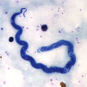 <p>sheathed, nuclei in da tail</p>