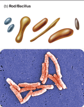 <p>what type? </p>