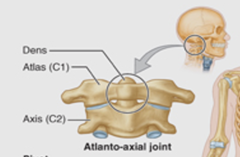 <p>Name the type of joint</p>