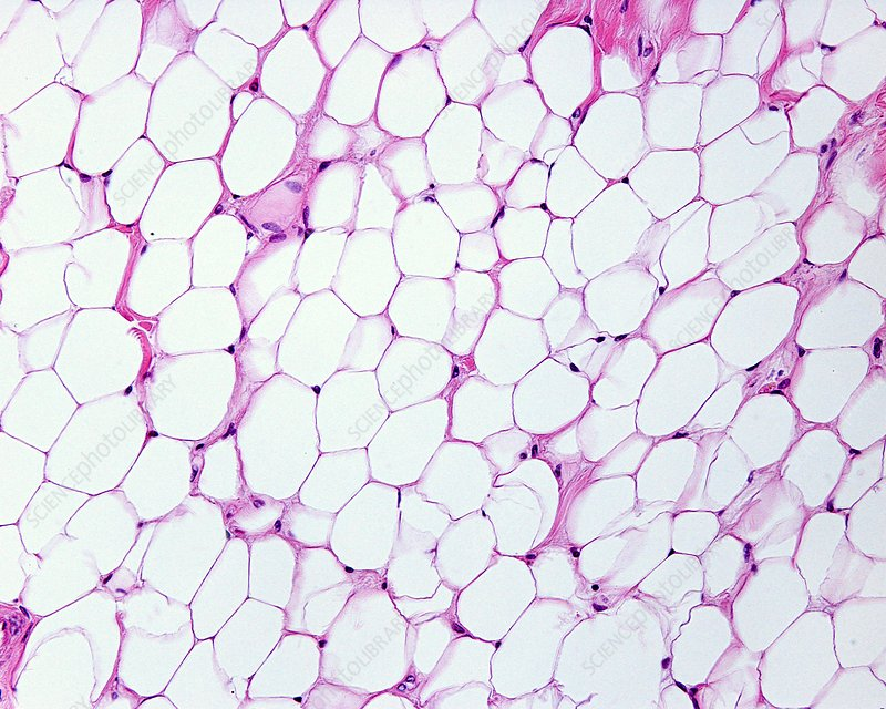 <p>-Function: Stores energy, insulates the body, and cushions/protects organs</p><p>-Found: Under the skin, around kidneys and other organs, and in bone marrow</p><p>-Description: Large cells filled with fat (~fat droplets), with nuclei pushed to the side</p>