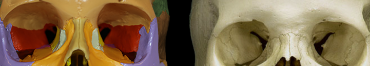 <p>Sphenoid</p>