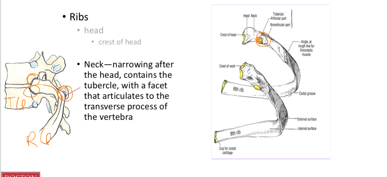 <p><span style="background-color: transparent;">Identify the bony features of an individual rib <strong>(Neck and Head)</strong></span></p>