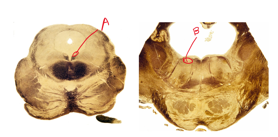 <p>Describe the symptoms of damaging A and B</p>