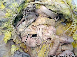<p>what structure is being indicated to (be specfic)?</p>